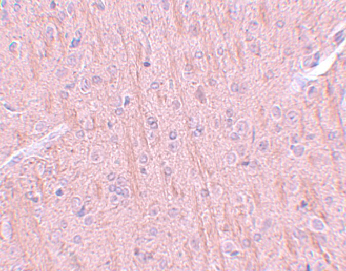 CCDC106 Antibody - BSA Free