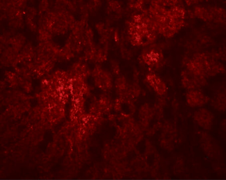 CCDC106 Antibody - BSA Free