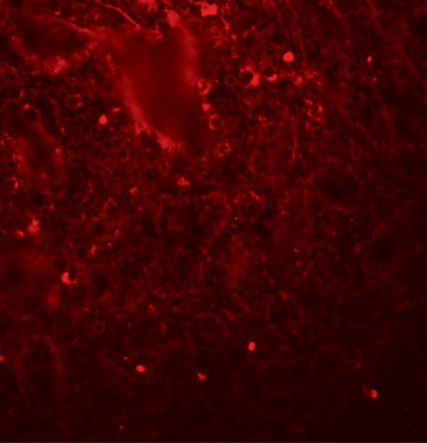 LIN-28A Antibody - BSA Free