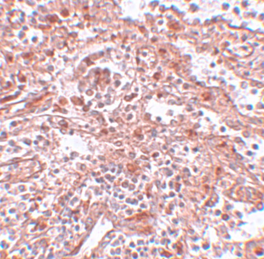 LIN-28A Antibody - BSA Free