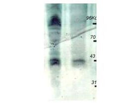Phosphothreonine Antibody [HRP]