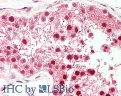 Pin1 Antibody