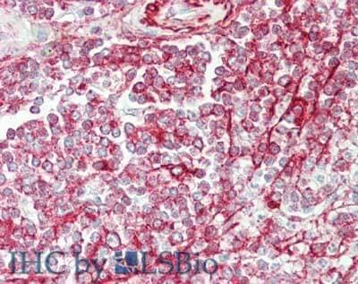 NCOA3/AIB1 Antibody