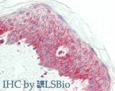 NCOA3/AIB1 Antibody