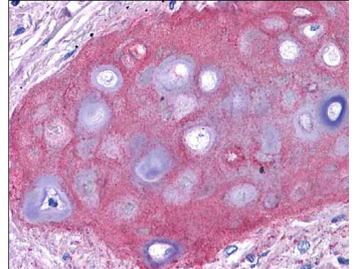 Collagen II Antibody