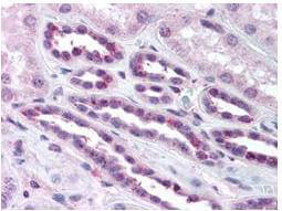 RelA/NFkB p65 [p Ser276] Antibody