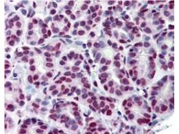 STAT5A [p Tyr694] Antibody (5F6.F1)