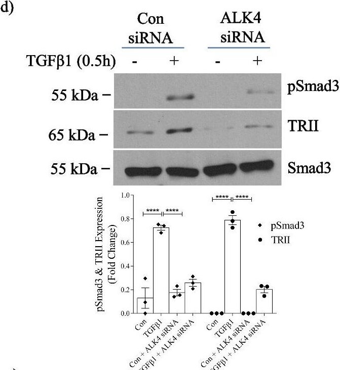 Smad3 [p Ser423, p Ser425] Antibody - BSA Free