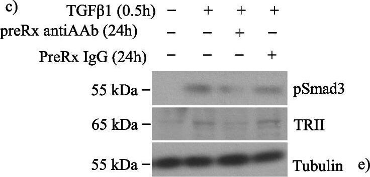 Smad3 [p Ser423, p Ser425] Antibody - BSA Free