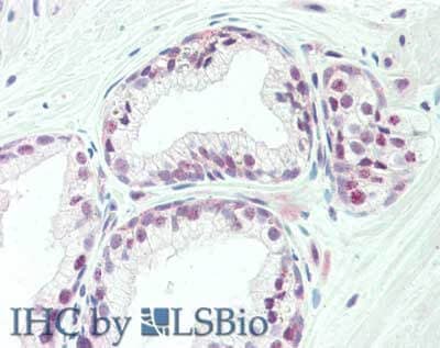 KAT4/TBP Associated Factor 1 Antibody