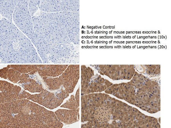 IL-6 Antibody