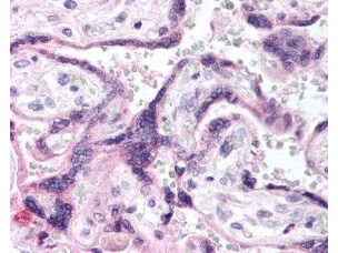 EGFR [p Tyr1197] Antibody