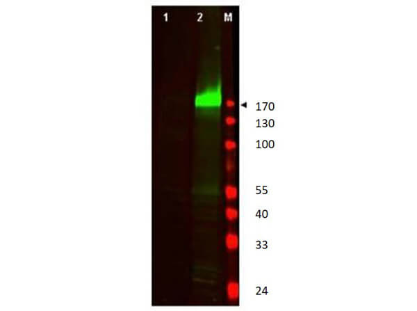 EGFR [p Tyr1197] Antibody