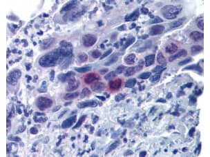 MLF1 Interacting Protein [p Thr78] Antibody