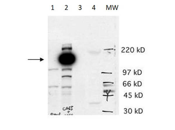 CASZ1 Antibody