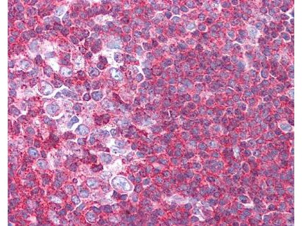 SIPA1 Antibody