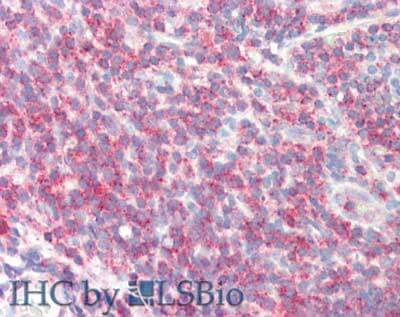 SIPA1 Antibody