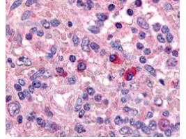 Artemis Antibody