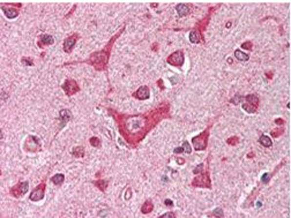 CaMKIV Antibody