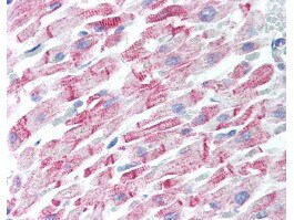 beta Amyloid Antibody