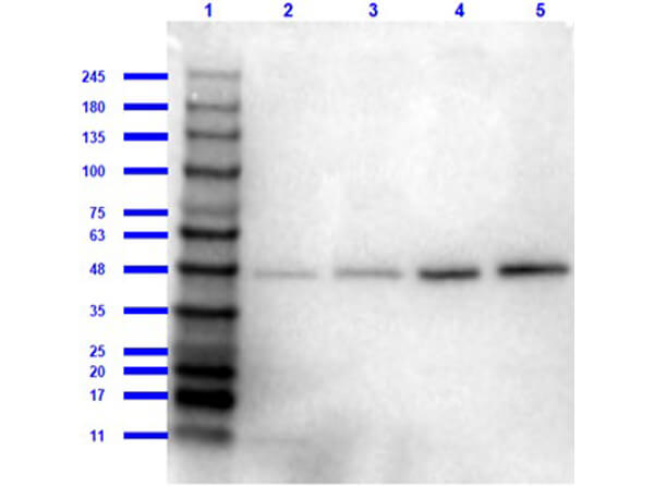 beta Amyloid Antibody