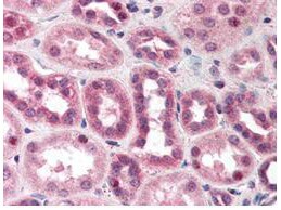 Cullin 5 Antibody - N-terminal