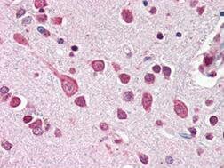 Cullin-7 Antibody - C-terminus