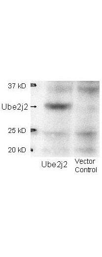 UBE2J2/UBC6 Antibody