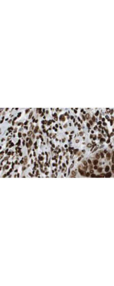 HDAC1 Antibody