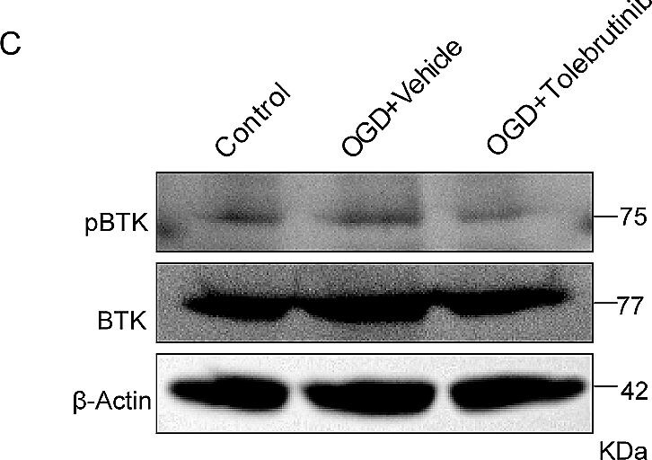 BTK [p Tyr223] Antibody - BSA Free