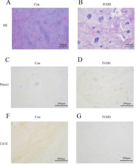 PIEZO1 Antibody - BSA Free