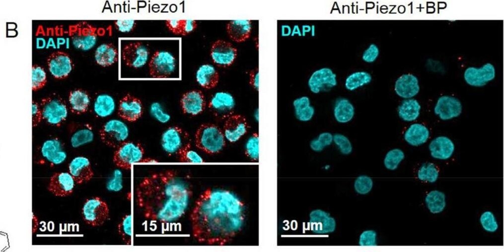 PIEZO1 Antibody - BSA Free