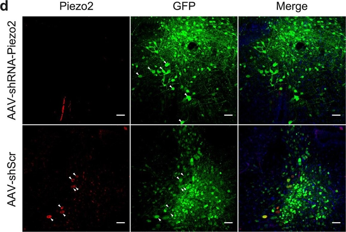 PIEZO2 Antibody - BSA Free