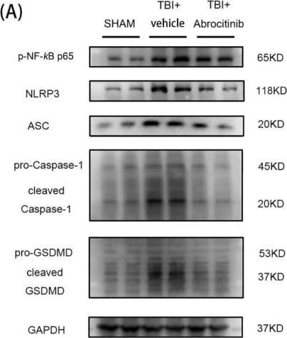 ASC/TMS1 Antibody - BSA Free
