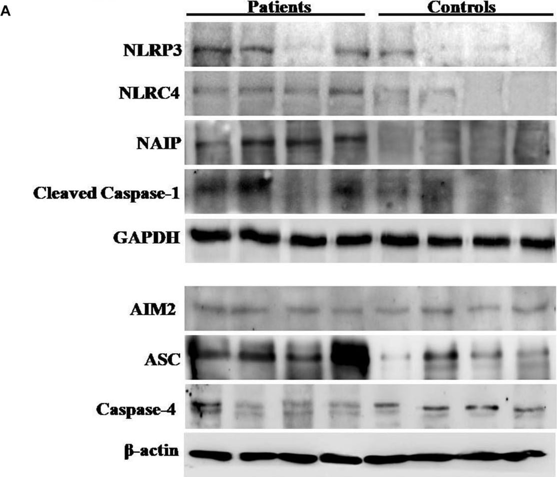 ASC/TMS1 Antibody - BSA Free