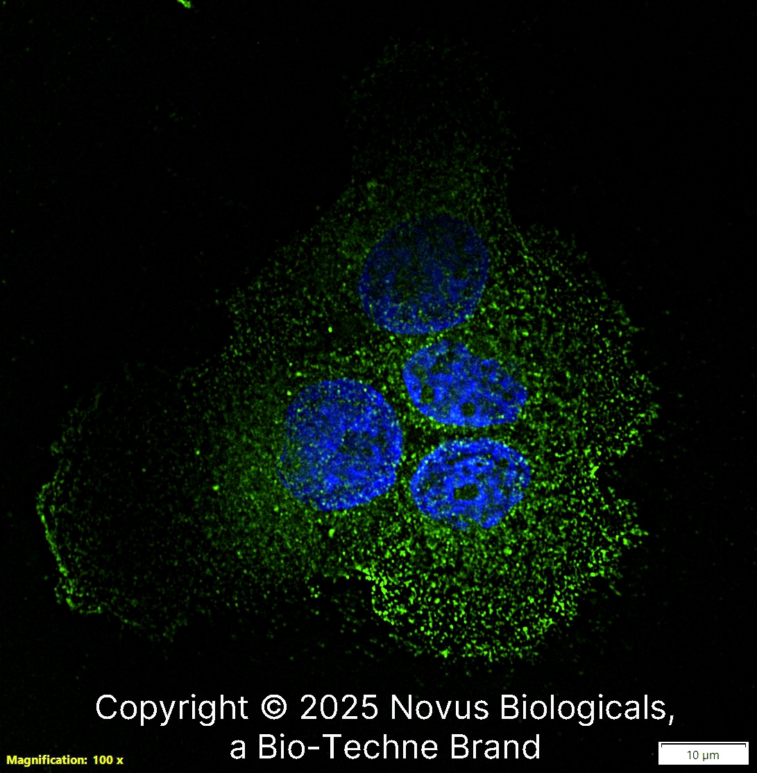 Desmoglein-3 Antibody (5H10) [Alexa Fluor® 488]