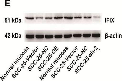 PYHIN1 Antibody - BSA Free