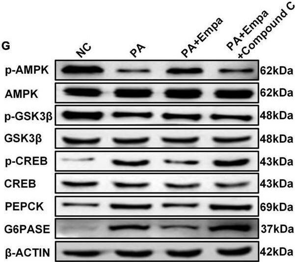 G6PC Antibody - BSA Free