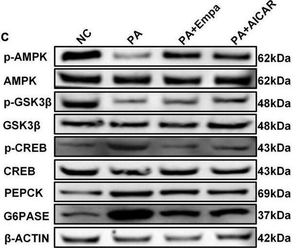 G6PC Antibody - BSA Free