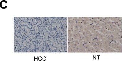 PCNA associated factor Antibody