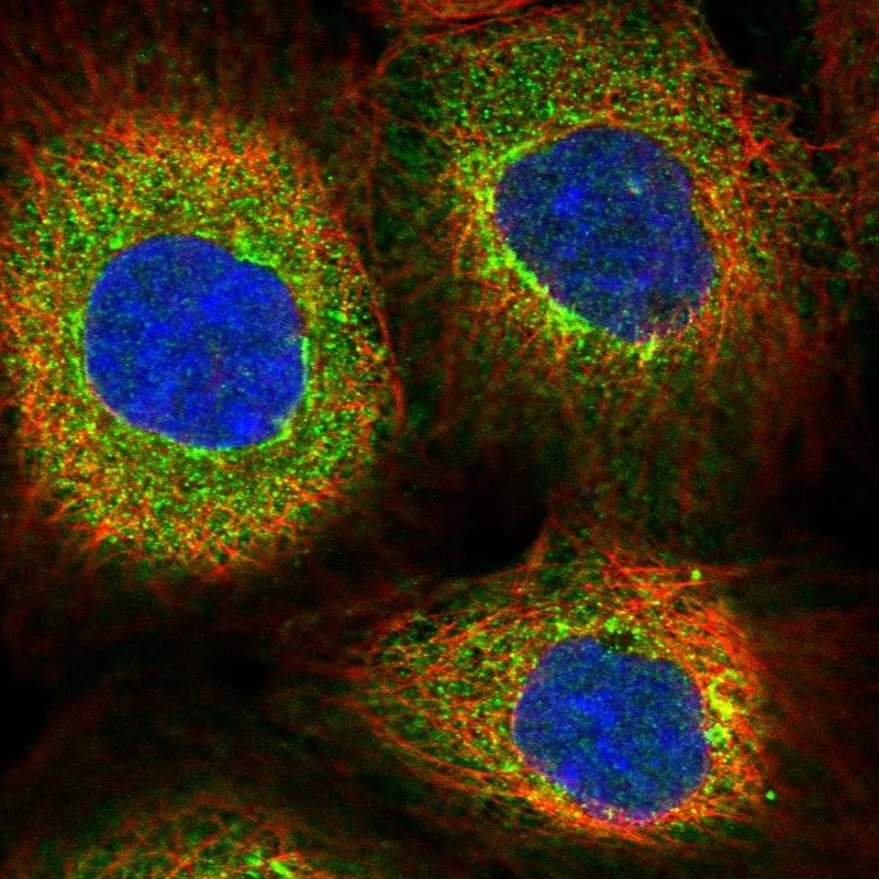 S100A3 Antibody Immunocytochemistry/ Immunofluorescence: S100A3 Antibody [NBP1-87101]