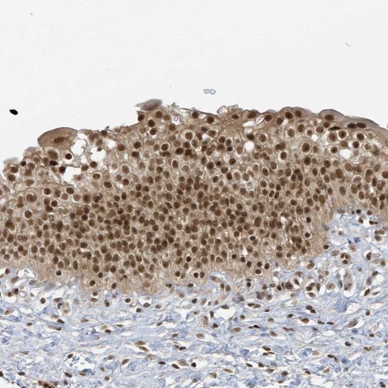 ZNF740 Antibody - BSA Free Immunohistochemistry-Paraffin: ZNF740 Antibody [NBP1-80602]