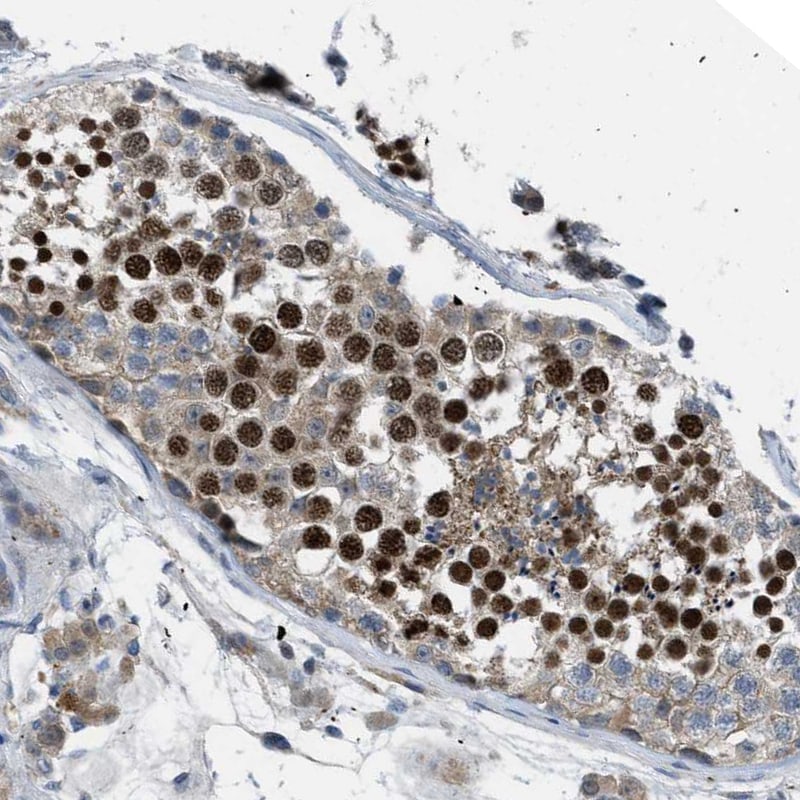 BAZ2B Antibody - BSA Free Immunohistochemistry: BAZ2B Antibody - BSA Free [NBP1-80622]