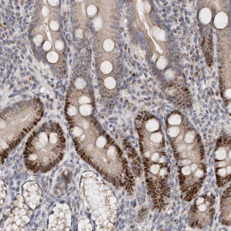 KLF7 Antibody - BSA Free Immunohistochemistry: KLF7 Antibody - BSA Free [NBP1-80638]