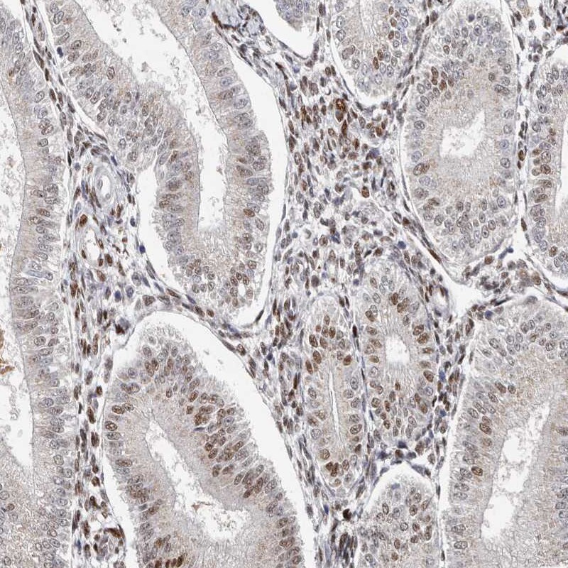 KLF7 Antibody - BSA Free Immunohistochemistry: KLF7 Antibody - BSA Free [NBP1-80638]