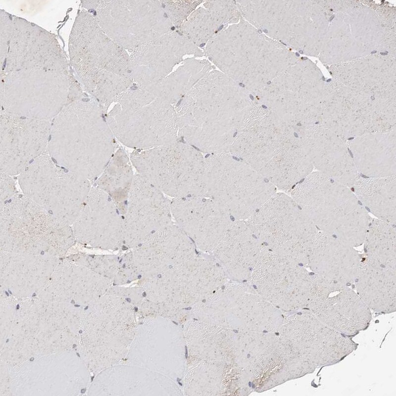 KLF7 Antibody - BSA Free Immunohistochemistry: KLF7 Antibody - BSA Free [NBP1-80638]