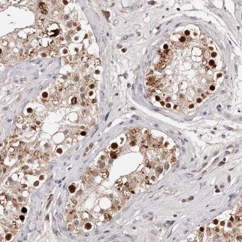 KLF7 Antibody - BSA Free Immunohistochemistry: KLF7 Antibody - BSA Free [NBP1-80638]