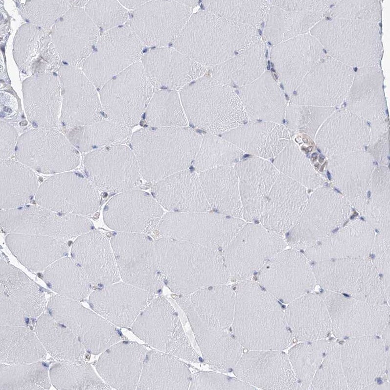 USP11 Antibody - BSA Free Immunohistochemistry-Paraffin: USP11 Antibody [NBP1-80639]