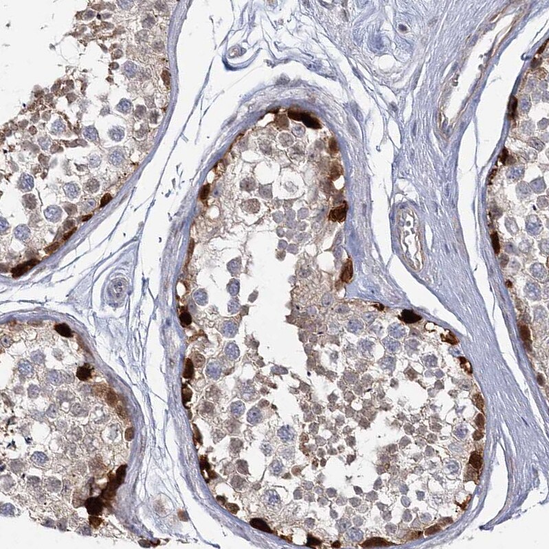 USP11 Antibody - BSA Free Immunohistochemistry-Paraffin: USP11 Antibody [NBP1-80639]