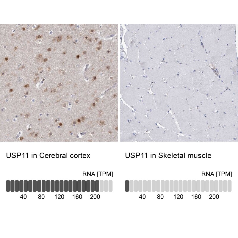 USP11 Antibody - BSA Free Immunohistochemistry-Paraffin: USP11 Antibody [NBP1-80639]